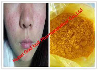 China Gelbe Farbrohe Steroid-Pulver/Isotretinoin für Haut-Krebse, CAS 4759-48-2 fournisseur